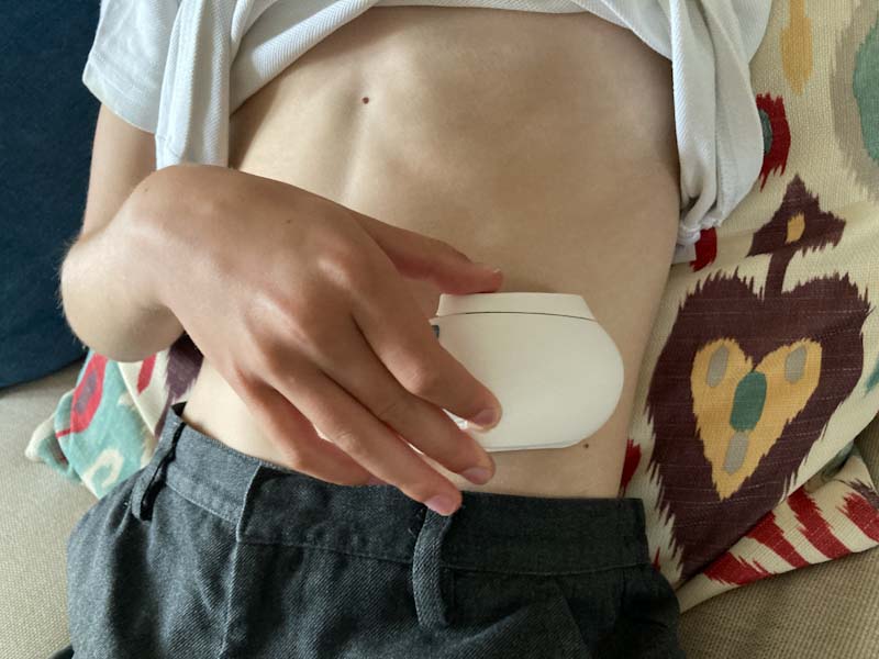 A child is not a small adult. Challenges and solutions in developing drug delivery devices for children